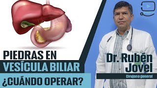 🩺VESÍCULA BILIAR: Enfermedades y síntomas - Dr. Jovel | cirujano general