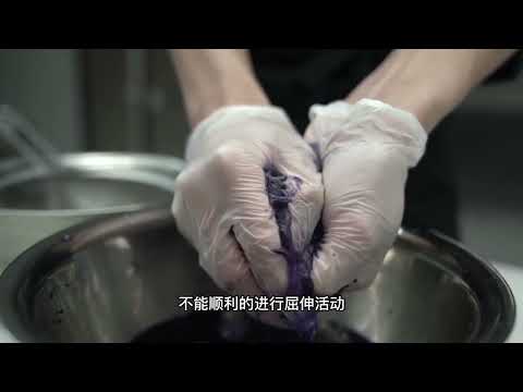 屈指肌腱狭窄性腱鞘炎（弹响指）