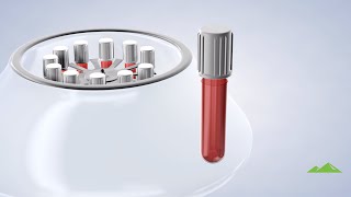 Platelet Rich Plasma at Utah Surgical Arts, South Jordan, UT