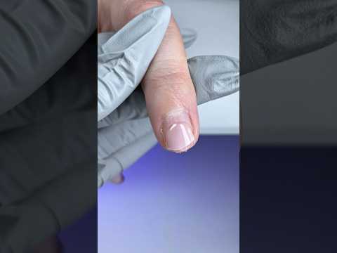 Fiberglass Mesh & Dual Forms. Repair Broken Nail