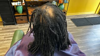 Hair Loss Transformation Journey | Genetics and Locs Impacted her hair loss and caused balding