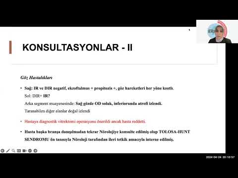 Emek Gerektiren Olgular EGO 24 nisan 2024