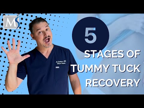 Tummy Tuck Recovery - 5 stages
