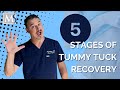 Tummy Tuck Recovery 5 Stages