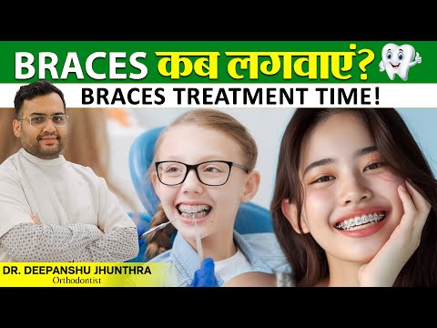 Braces Treatment Right Age and Duration