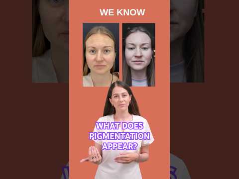 Why does pigmentation appear? Causes of pigmentation