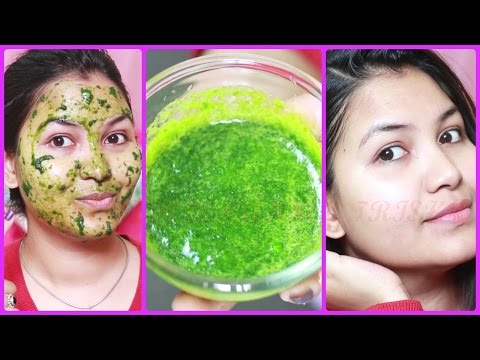 Get bright & clear complexion/remove acne, pimples/Super effective spinach face mask Video