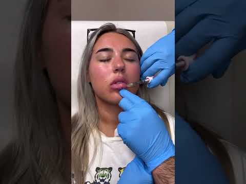 Videos - New Orleans, LA - Khoobehi Plastic Surgery