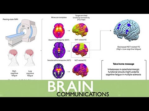 Alterations in the functional connectivity of monoamine circuits in cognitive fatigue in MS