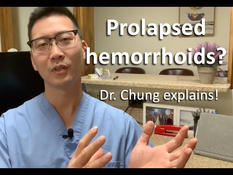 Can prolapsing hemorrhoids GO AWAY or DISAPPEAR? Dr. Chung explains!
