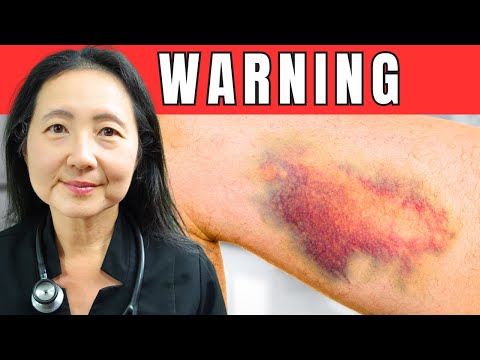 5 Symptoms to Never Ignore In Your Abdomen