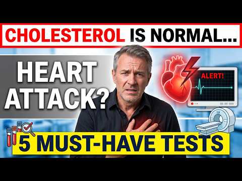 Cholesterol Tests