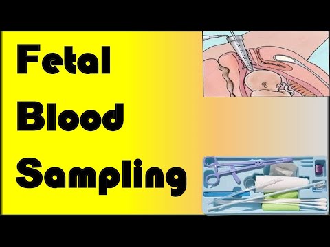 Fetal Blood Sampling