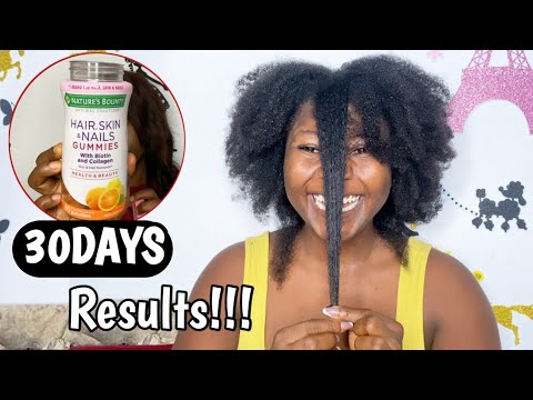 30DAYS Nature's Bounty Gummies Hair Growth Results |...