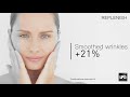 LPG Endermologie Face At BodySmart