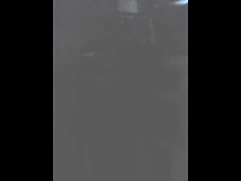 Dolore acuto durante i turni Dolori articolari con gonfiore