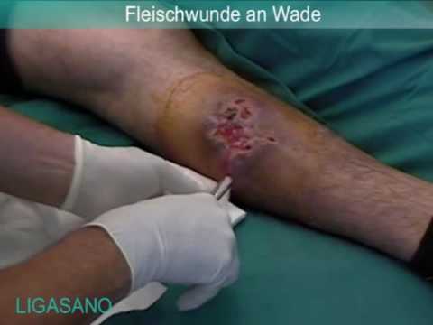 Rückenschmerzen aufgeben taub Wirbelsäulenbehandlung massagers