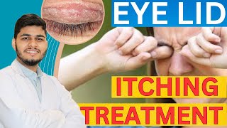 Eye Itching: Causes, Treatment, Home remedies | Itching under Eye Skin