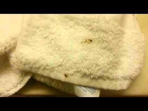 Super 8 and bed bugs
