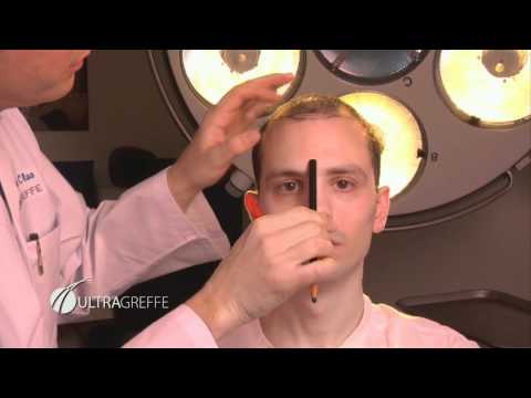 Ultragreffe - Capsule5 (EN)