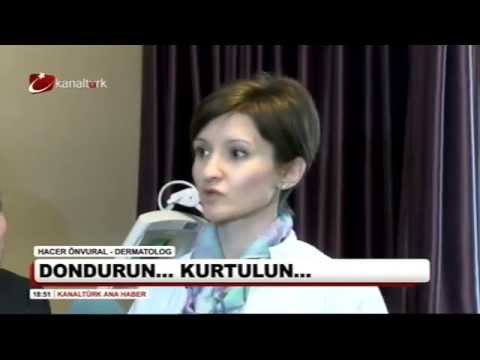 anaerob baktériumok meghatározása a parazita idény