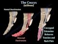 Coccyx, Tailbone pain /coccydynia - Everything You ...