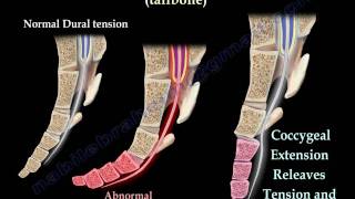 Coccyx, Tailbone pain /coccydynia - Everything You Need To Know - Dr. Nabil Ebraheim