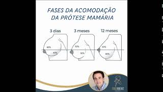 Acomodação da Prótese Mamária