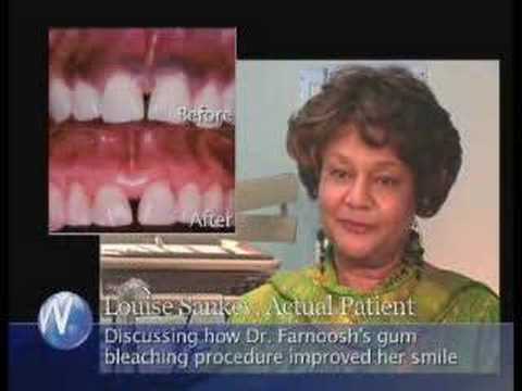 Testimonials - Smile Makeover Patients of Los Angeles Periodontist Dr. Farnoosh