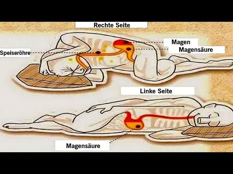 Zurück nach rechts oberhalb der Taille ausstrahlende Schmerzen nach oben упР° Ð »Ð ° Ð ± ол DN, ÑÐμÑ
