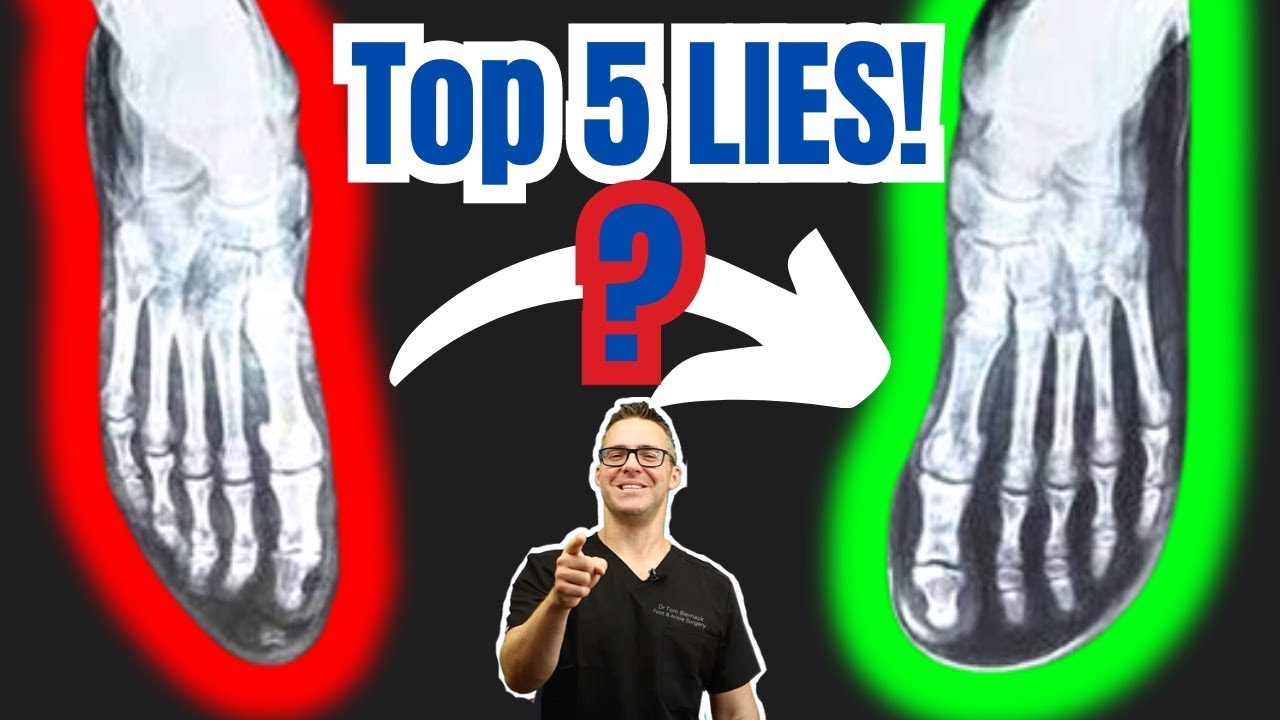 Top 5 Barefoot Shoes LIES! [Plantar Fasciitis, Bunions & Flat Feet]