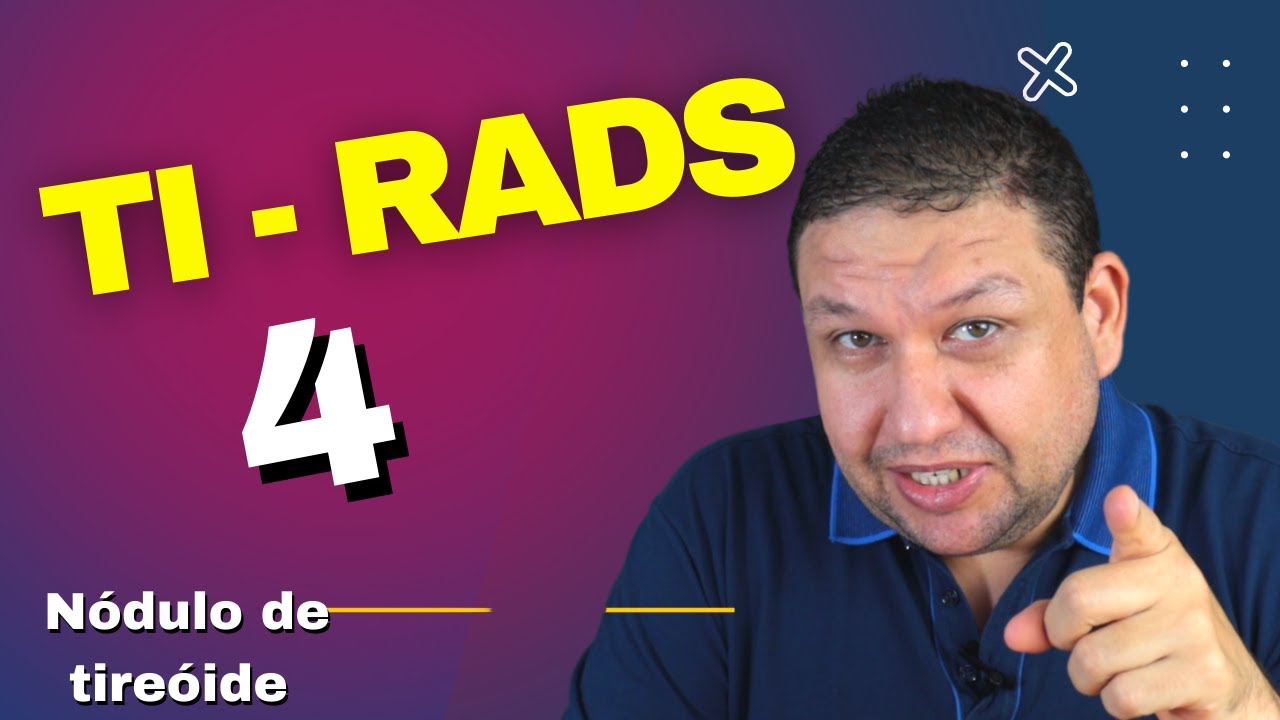 PUNÇÃO DA TIREÓIDE TI-RADS 4. JÁ É CÂNCER DE TIREÓIDE?