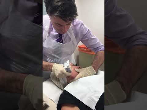 Dr Martin Wade Microneedling with SkinPren Precision