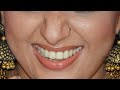 Kavya Madhavan Beautiful Vertical Closeup