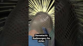 Gamma rays vs. abnormal blood vessels (3D Animation)