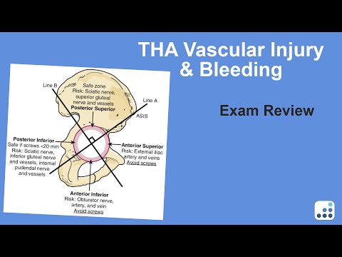 THA Vascular Injury & Bleeding Exam Review - William Barrett, MD