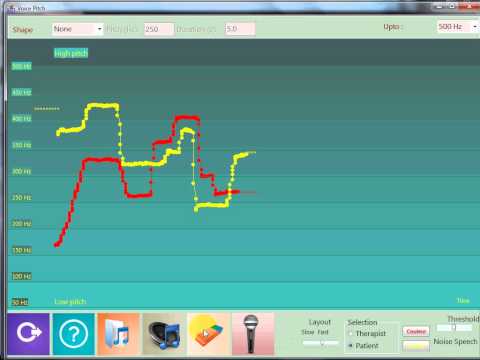 VOCALAB - The Pitch Tool of the Therapy Module