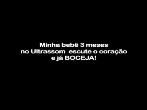 bebe da  Adriana boceja no Ultrassom , Yawning in ultrasound