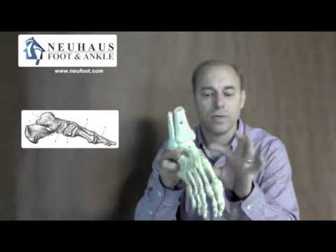 Foot Anatomy: Bones in the Feet