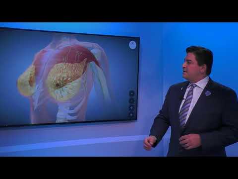 YouTube video about: How much is a breast lift in pa?