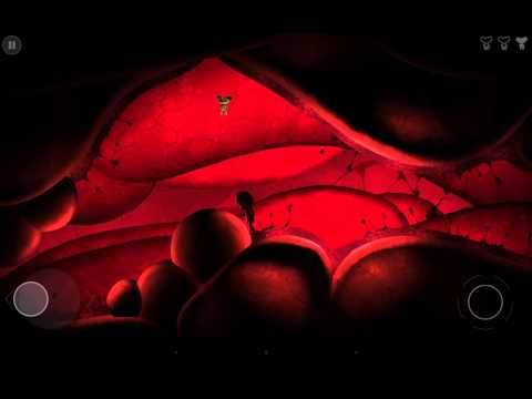 Nightmare: Malaria iOS / Android Gameplay Trailer HD