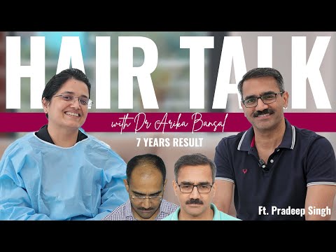 Long-Term Hair Transplant Results | After 7 Years of...