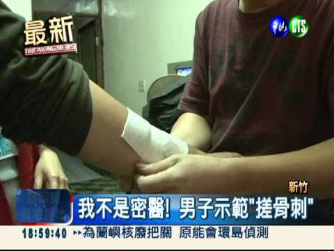 密醫搓皮長膿 誆骨刺流光光!