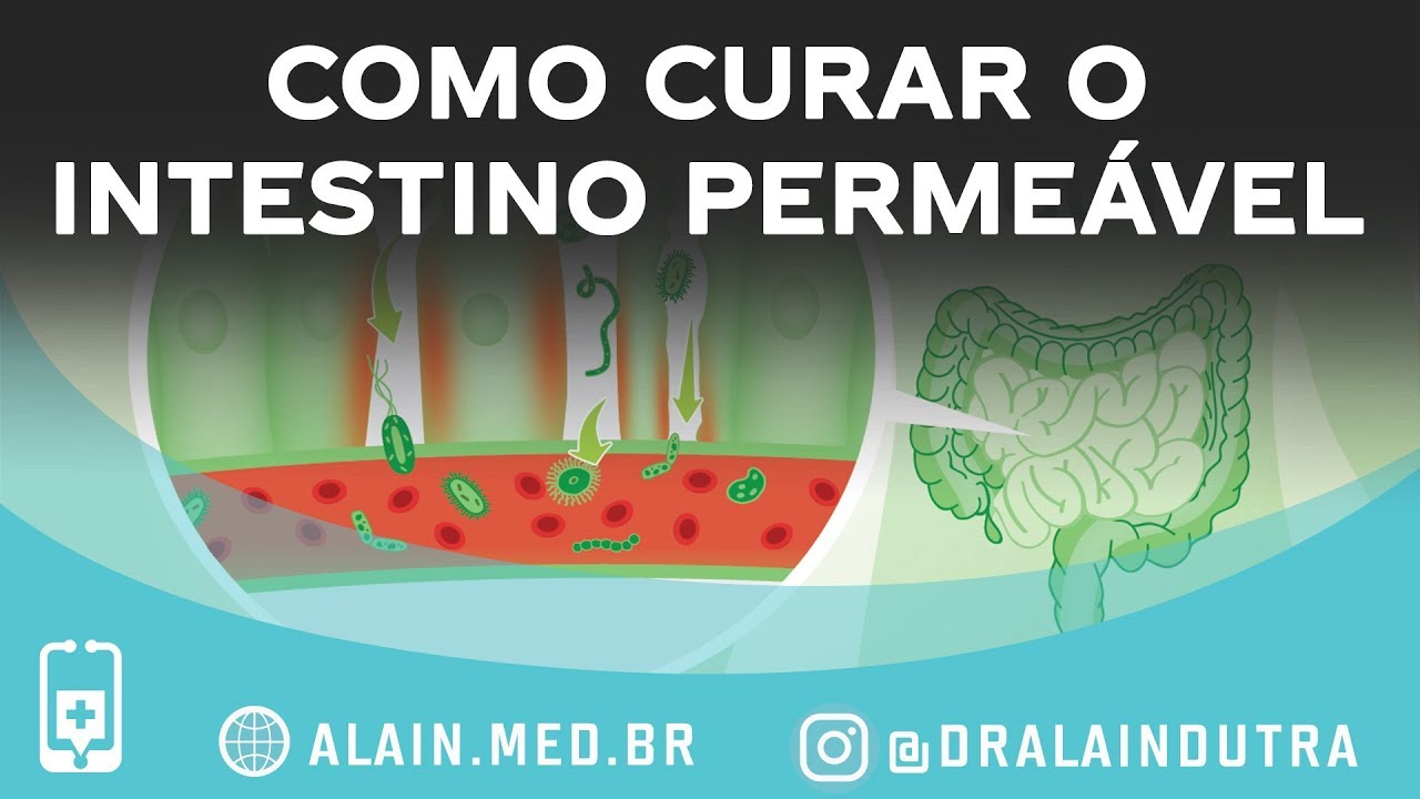Como curar o intestino hiperpermeável | medicina alternativa