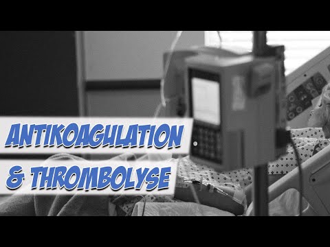 Antikoagulation und Thrombolyse | Krankheitslehre | Pflege Kanal
