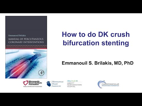 How to do DK crush: step-by-step in a bench model