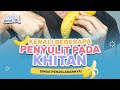 MACAM MACAM PENYULIT PADA KHITAN