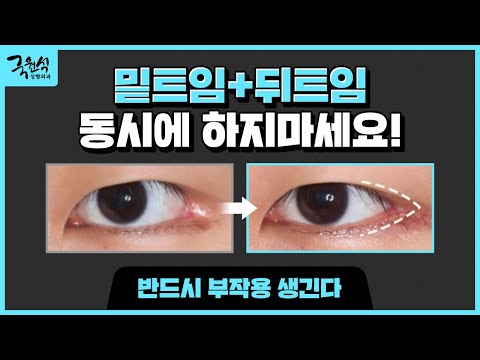 밑트임, 뒤트임 동시에 하지마세요