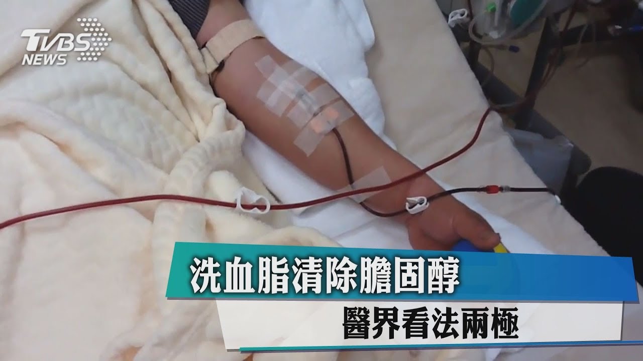 洗血脂清除膽固醇　醫界看法兩極