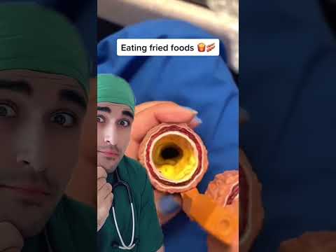 Do you have healthy arteries? #arteries #bloodvessels #medicalvideo #doctorexplains